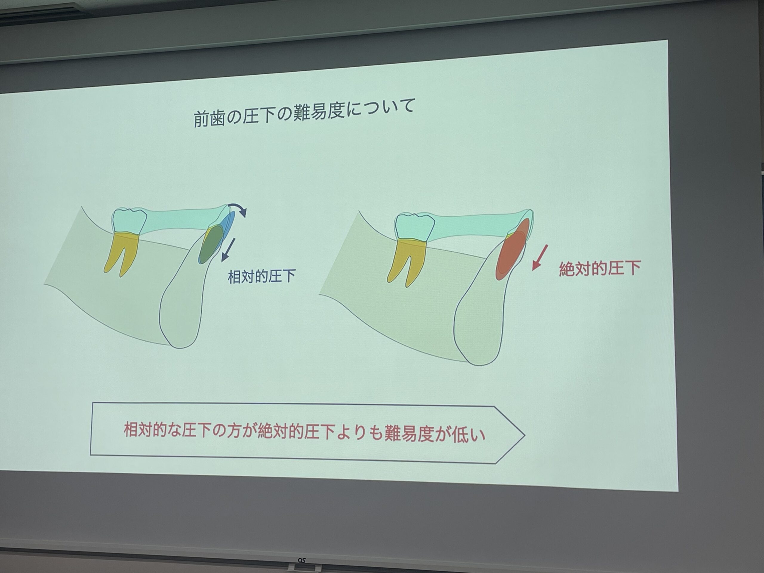 マウスピース（アライナー）矯正研修会