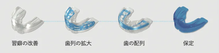マイオブレースシステムの仕組み
