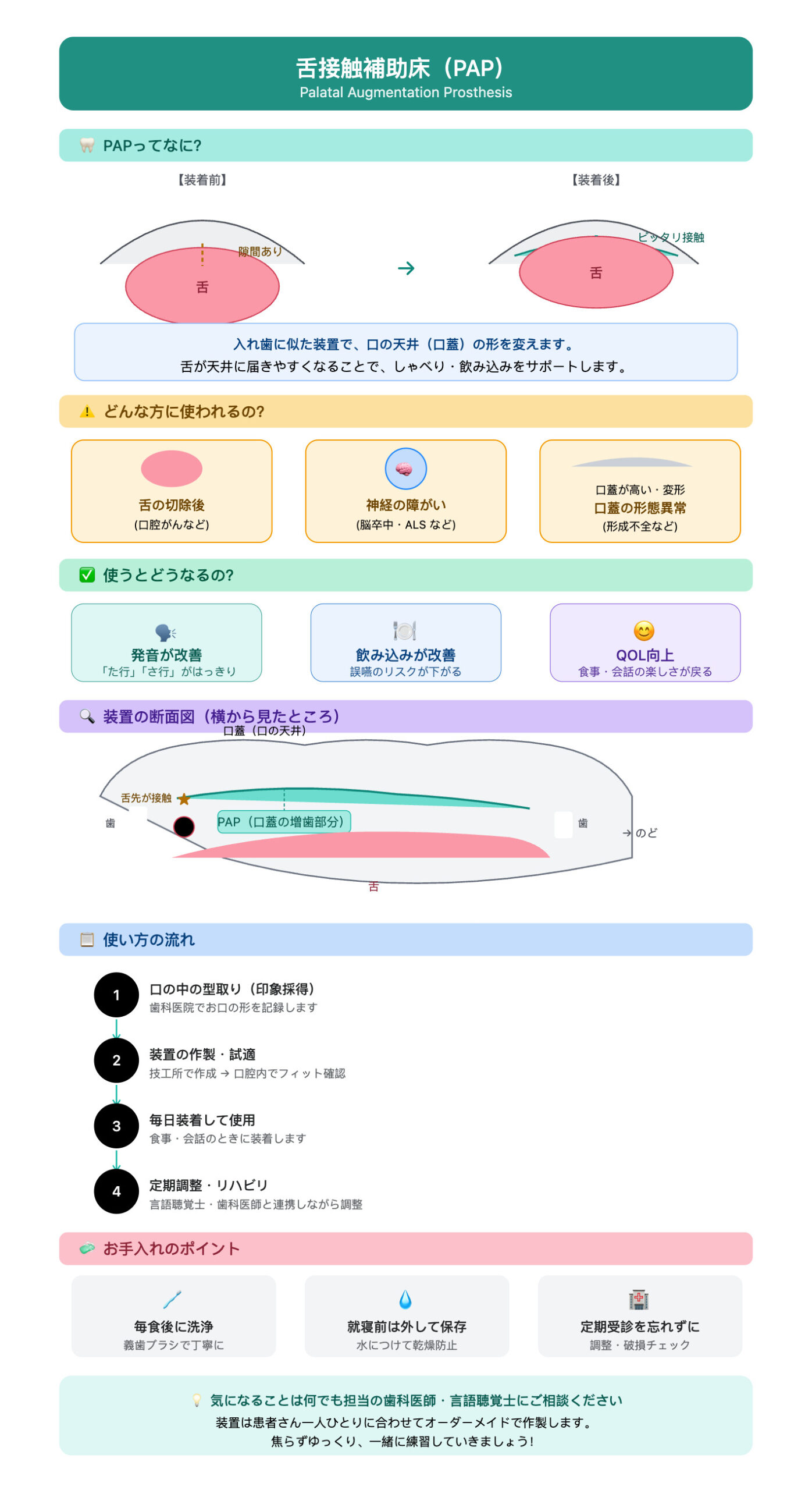 舌接触補助床(PAP)講習会